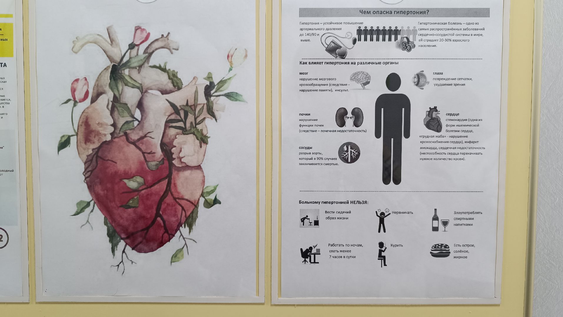 Лобня, медицина, гипертония