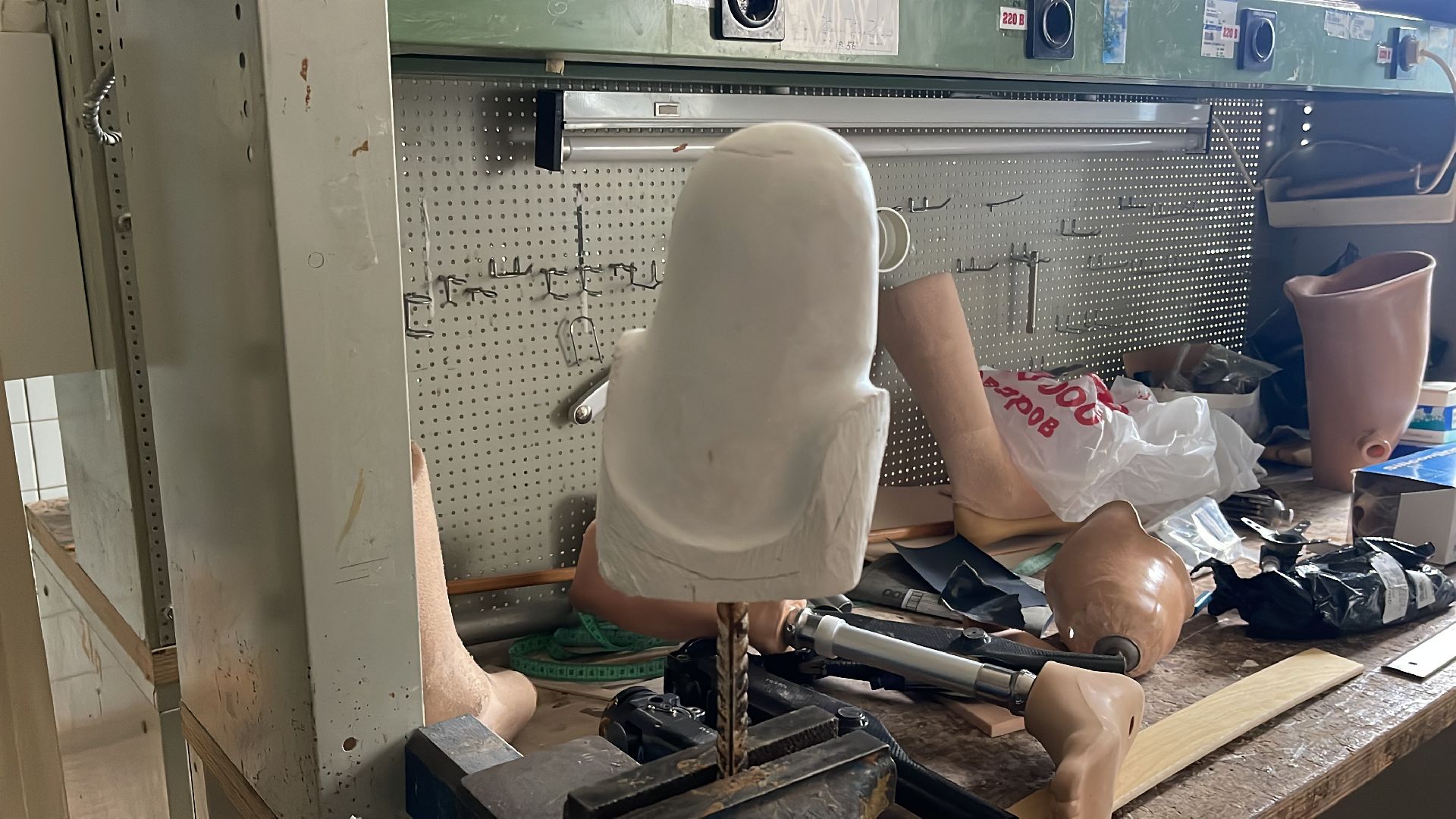 Руза, ЦВТ им. М. А .Лиходея, протез, реабилитация, Донецк, СВО