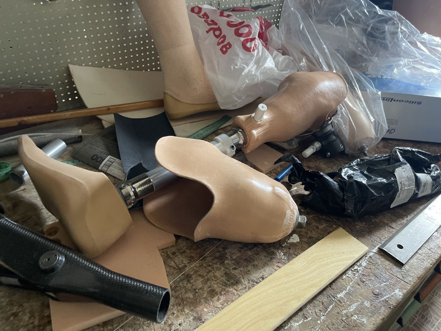 Руза, ЦВТ им. М. А .Лиходея, протез, реабилитация, Донецк, СВО