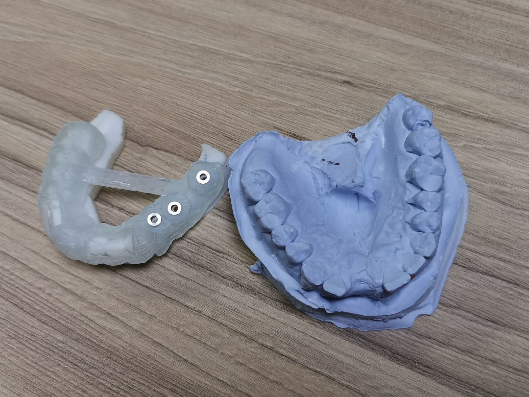 Подольск, медицина, протезы, стоматология