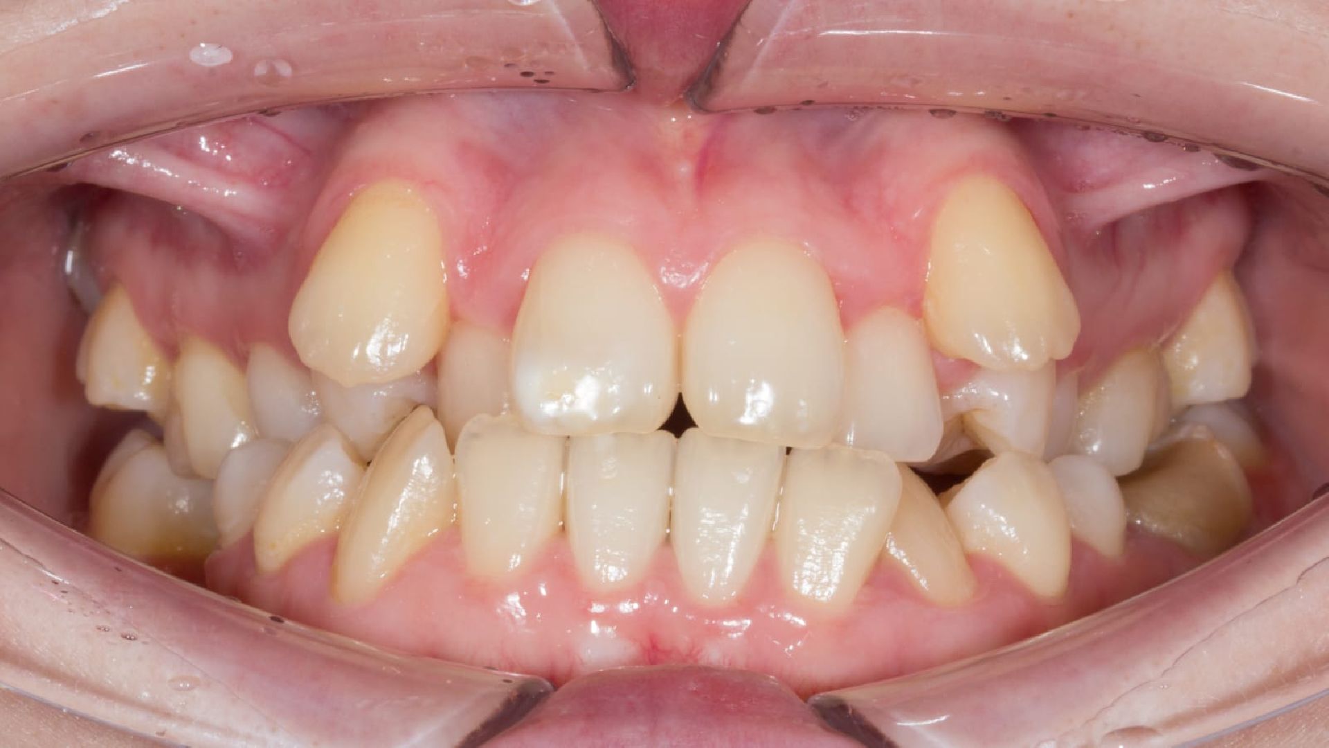 уникальная, операция, челюстно-лицевые, хирурги, аномалия