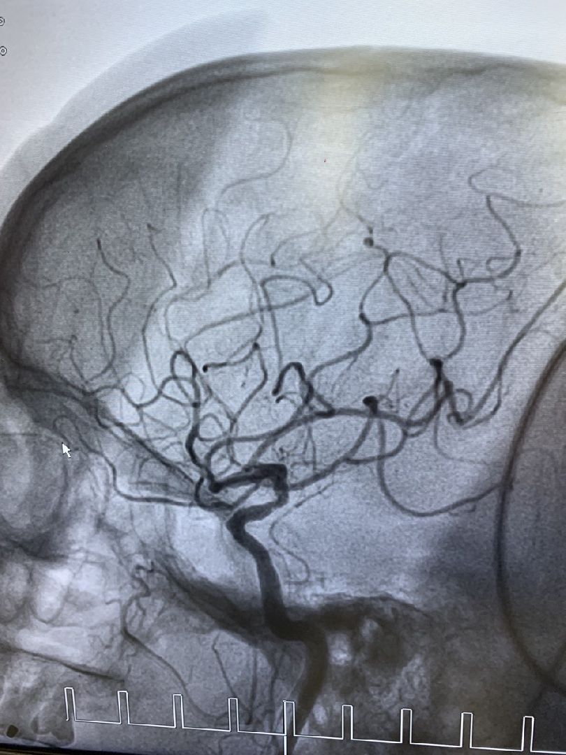 Дмитровская областная больница, Региональный сосудистый центр, Минздрав МО