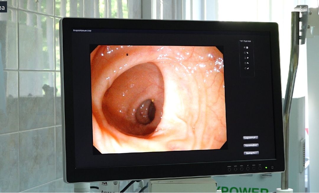 медицина, эндоскопия, Домодедово