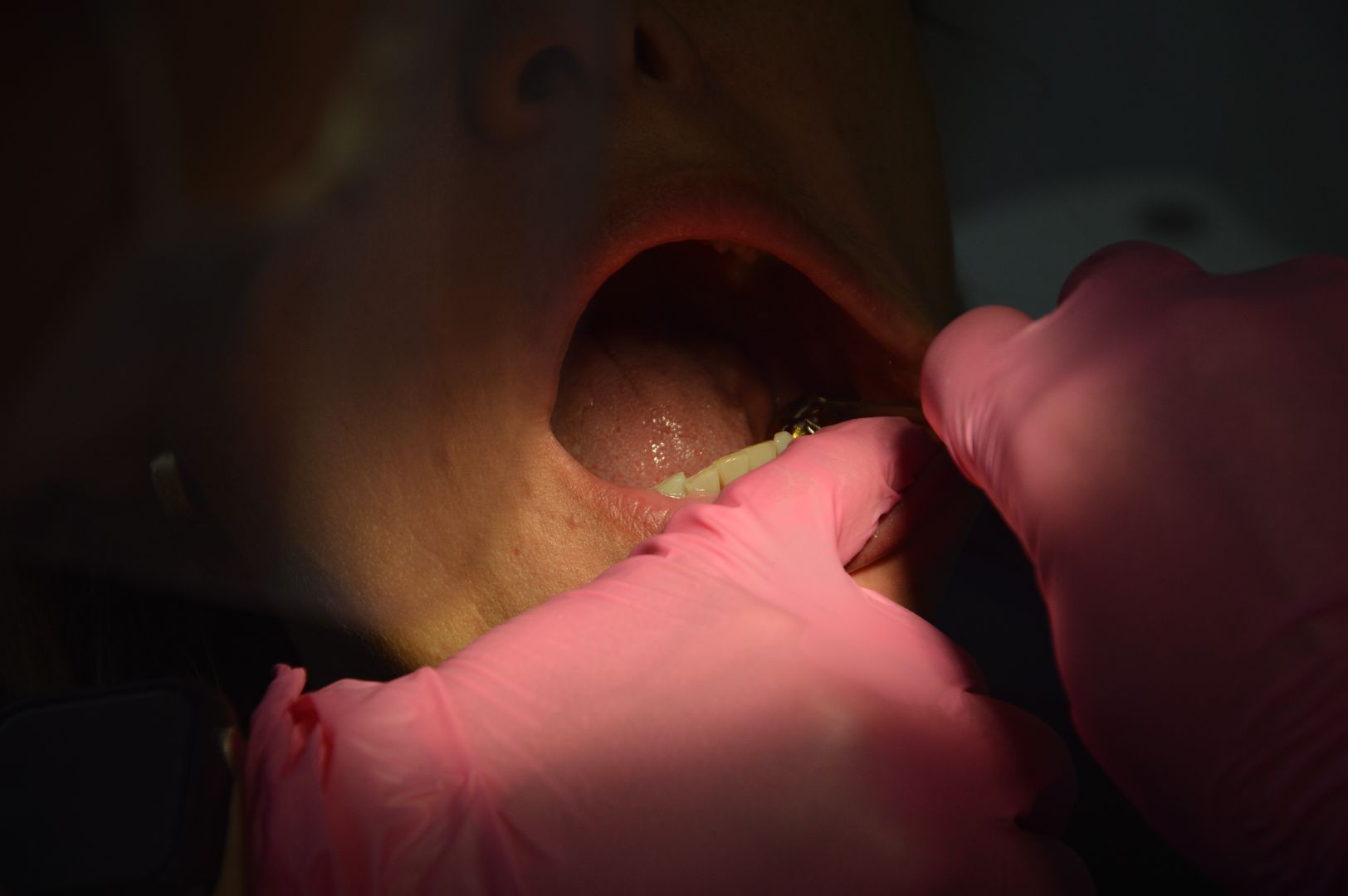 Шатура, стоматология, день медика,