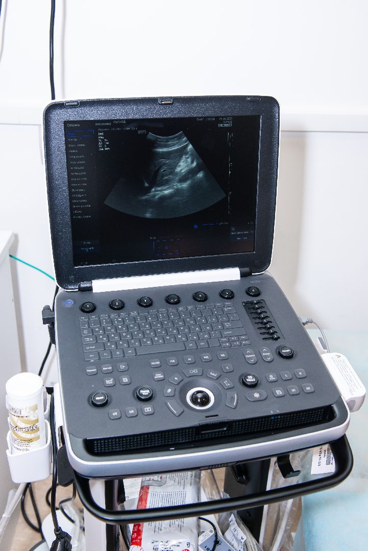 Солнечногорск, медицина, онкология, диагностика, УЗИ