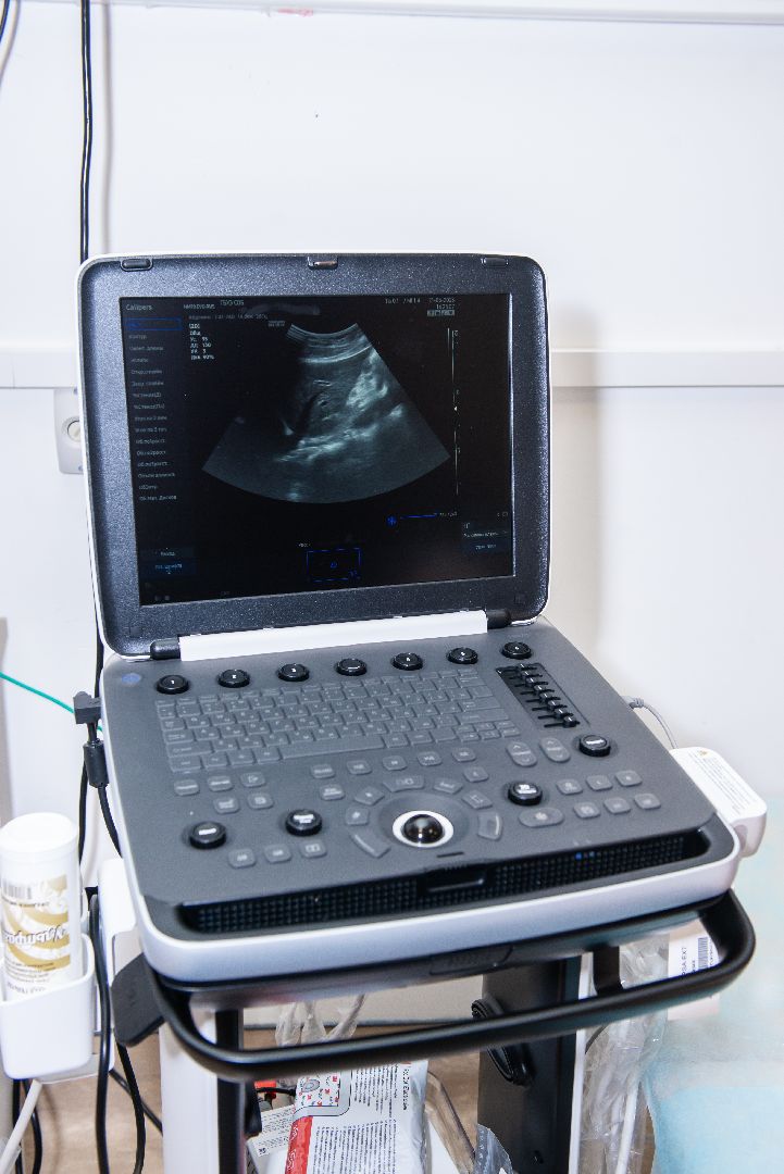 Солнечногорск, медицина, онкология, диагностика, УЗИ