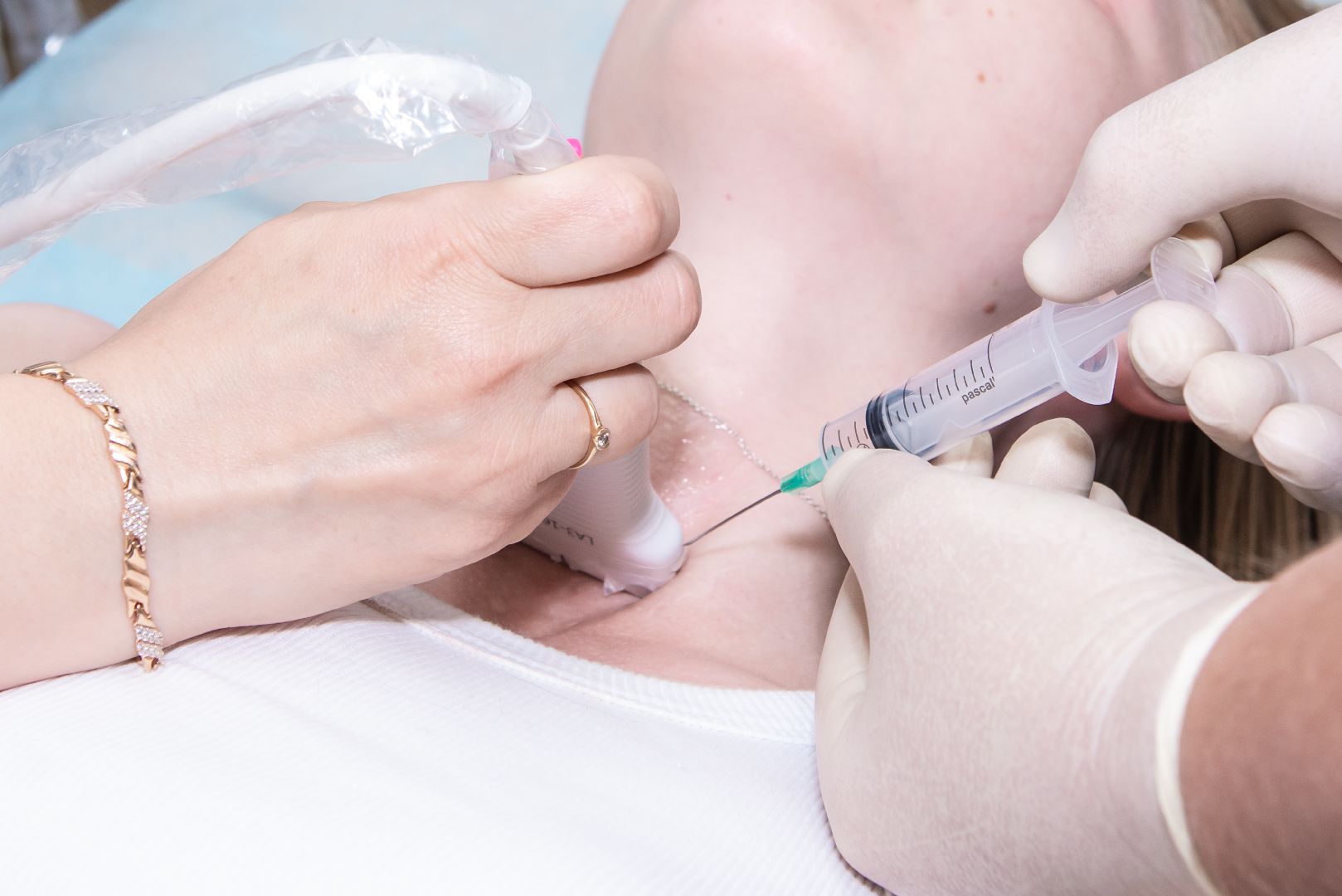 Солнечногорск, медицина, онкология, диагностика, УЗИ