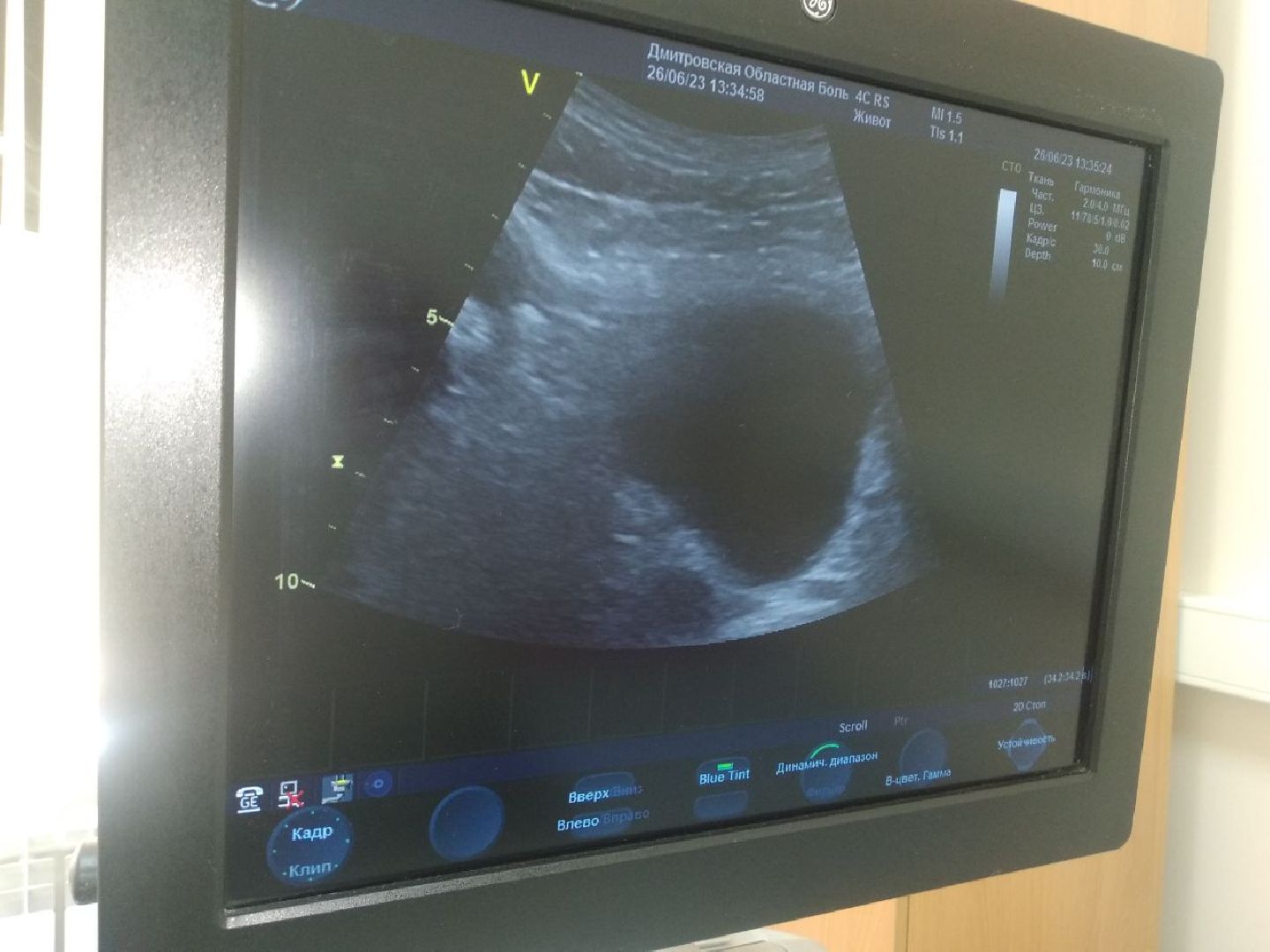 Дмитровская областная больница, врач УЗИ, Минздрав МО
