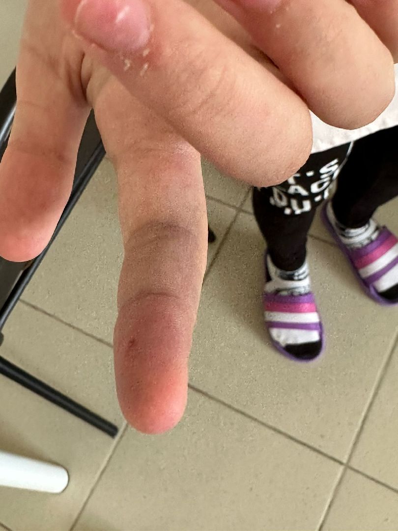 #гадюка, #талдом, #талдомскаяцрб, #советы, #медицина, #помощь