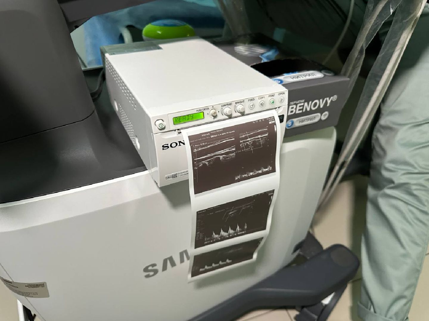 Реутов, здравоохранение, УЗИ, юбилей, врач