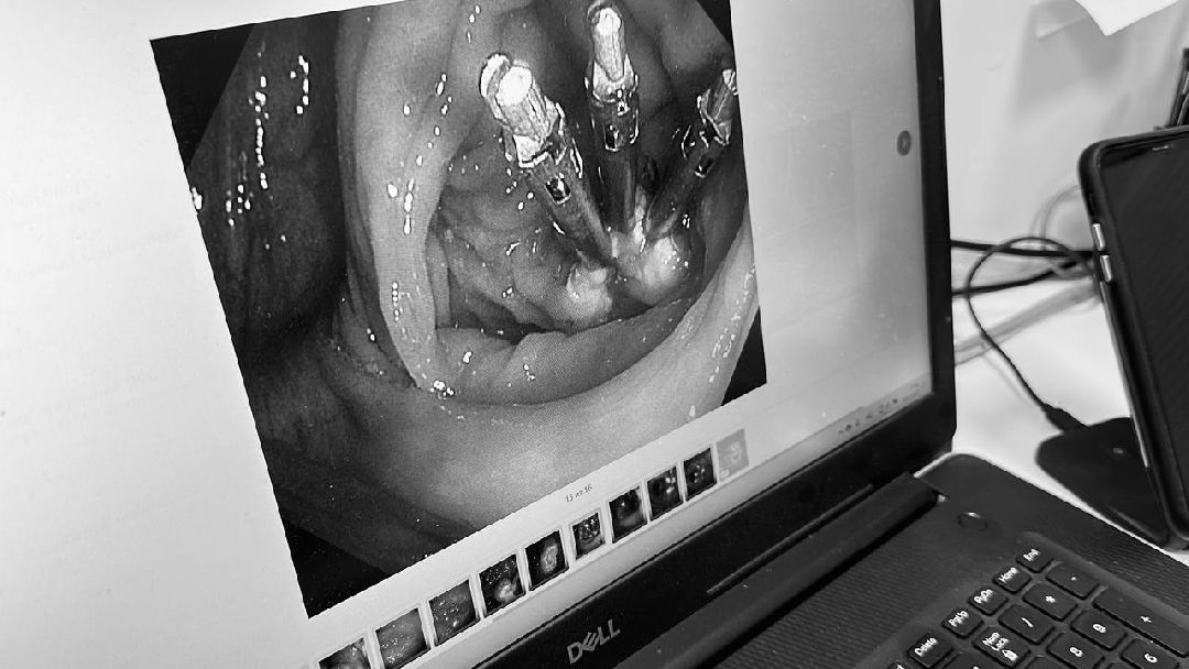 Одинцово, Онкология, Эндоскопическое оборудование, врач-онколог, диагностика раннего рака