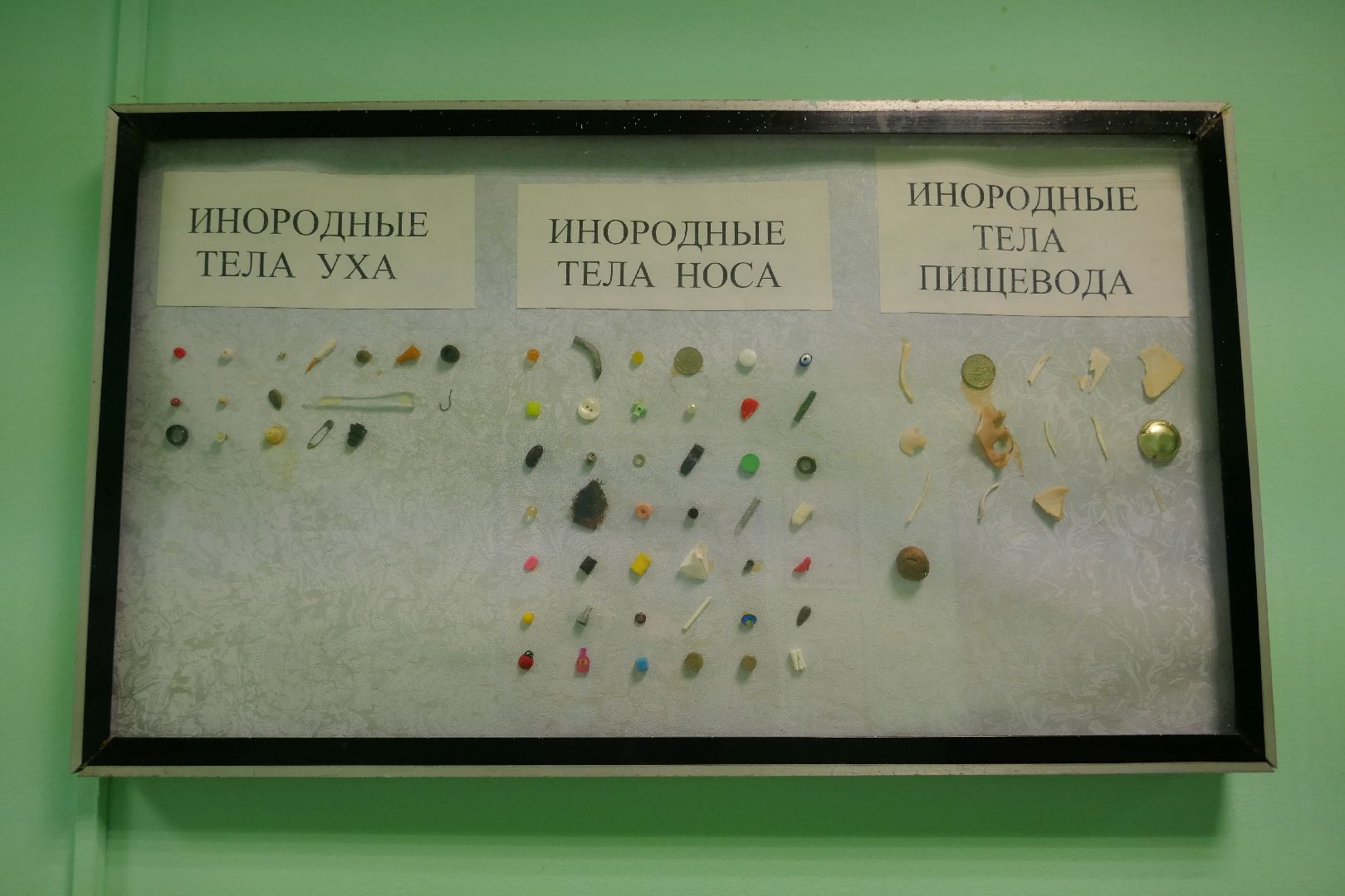 Подольск, медицина, лор, здравоохранение, операция, спасли жизнь