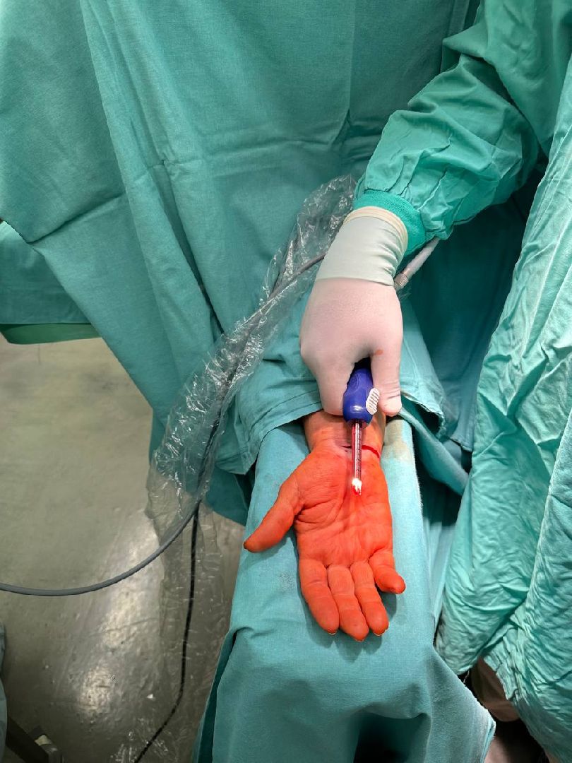 Подольск, медицина, нейрохирург, здоровье, операция