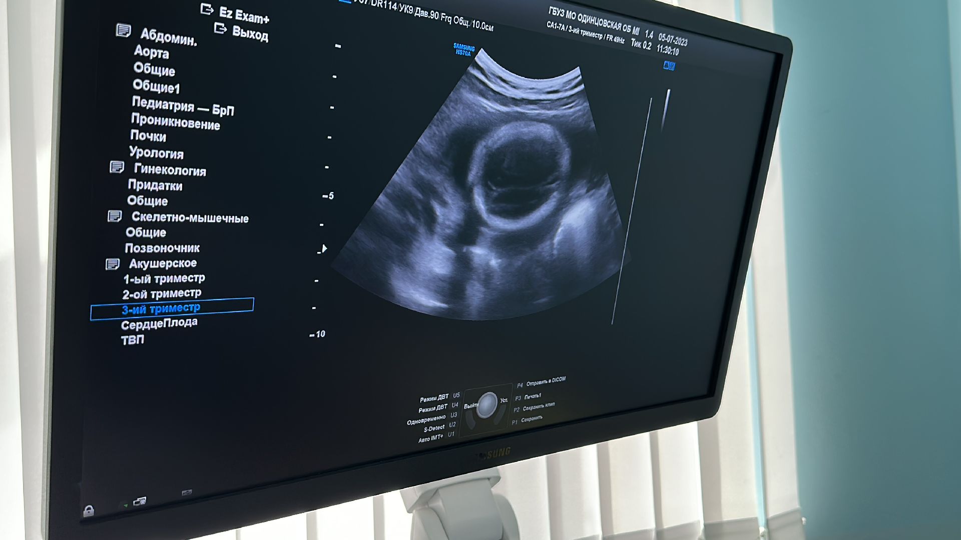 Одинцово, Роддом, Скрининг