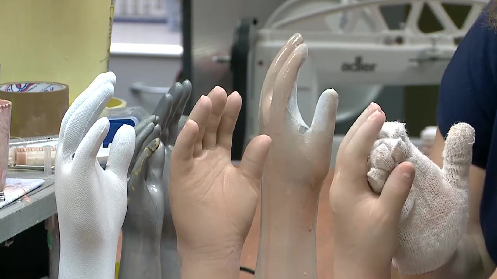 Реутов, СВО, протезы, кисть руки, стопа, коленный модуль, РЭЗСП