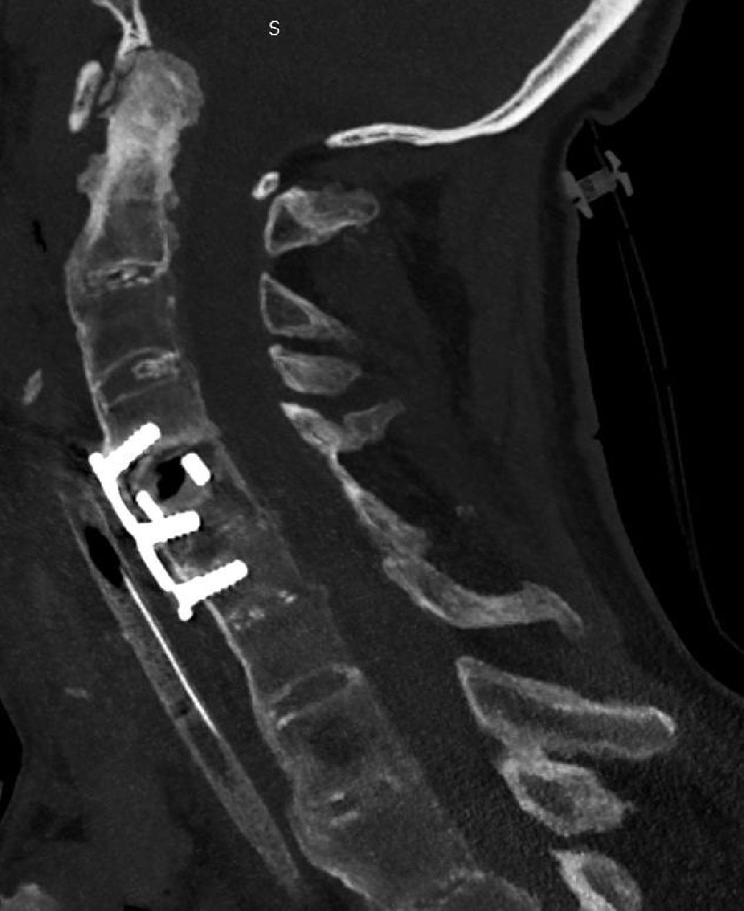 нейрохирурги, операция