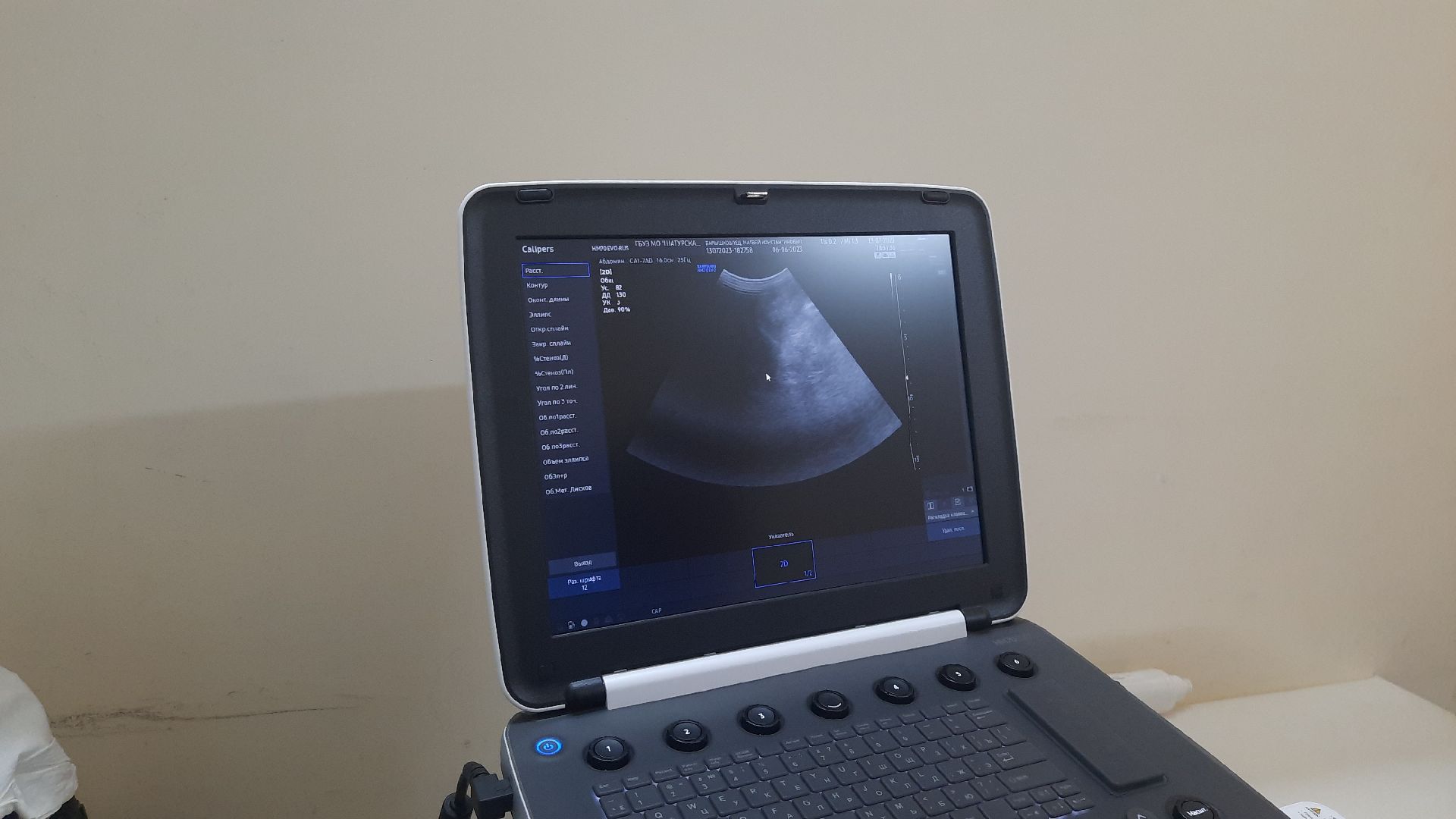 #Шатура, #новый. #УЗИ, #Аудиологический_скрининг. #медицина