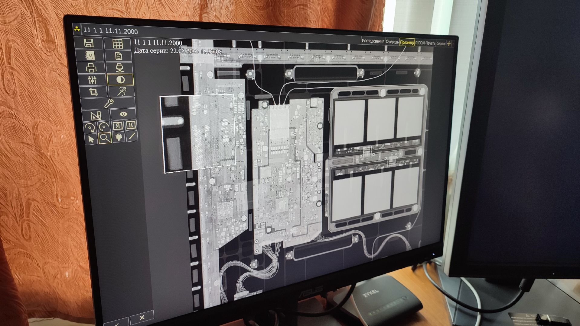 Кашира, медицина, рентген-аппарат, реанимация, хирургия, цифровизация