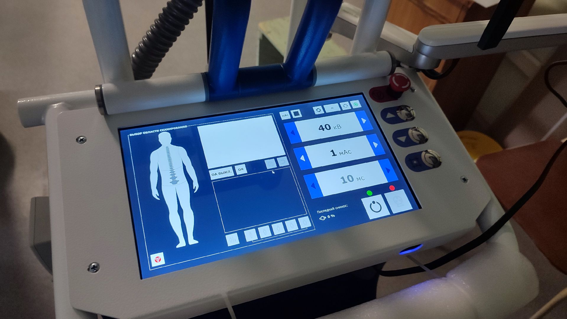 Кашира, медицина, рентген-аппарат, реанимация, хирургия, цифровизация