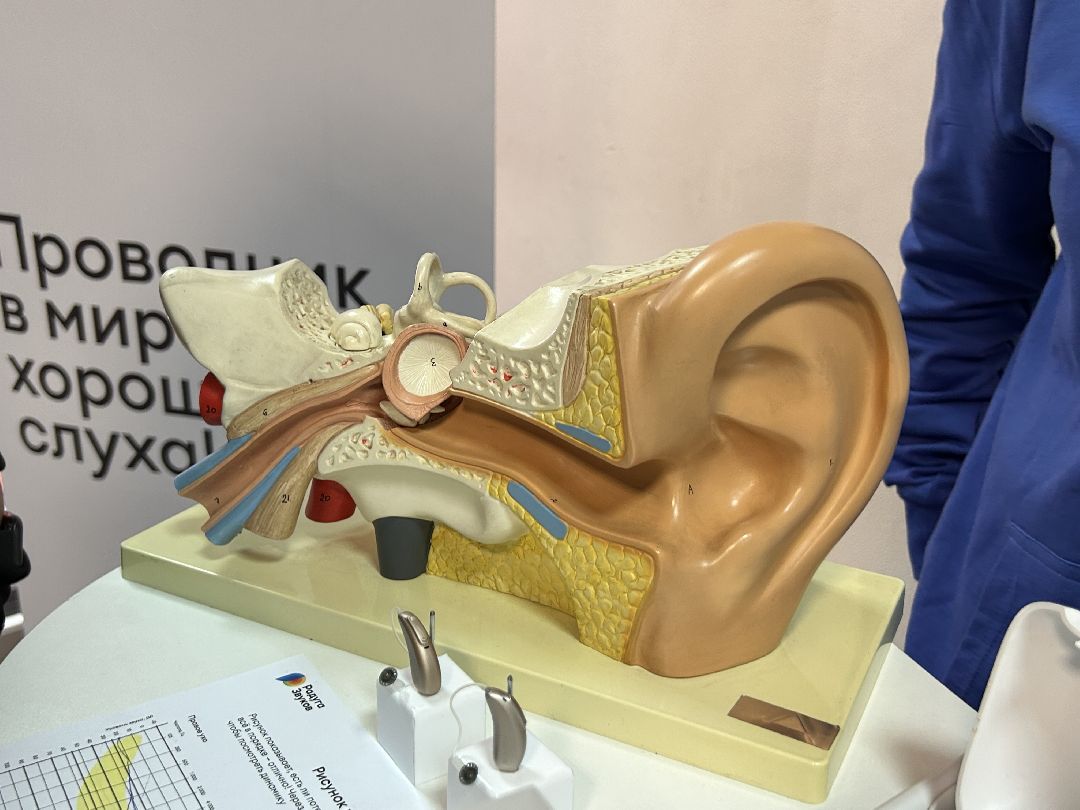 медицина, слуховые аппараты, слух, врачи, фестиваль, Фрязино