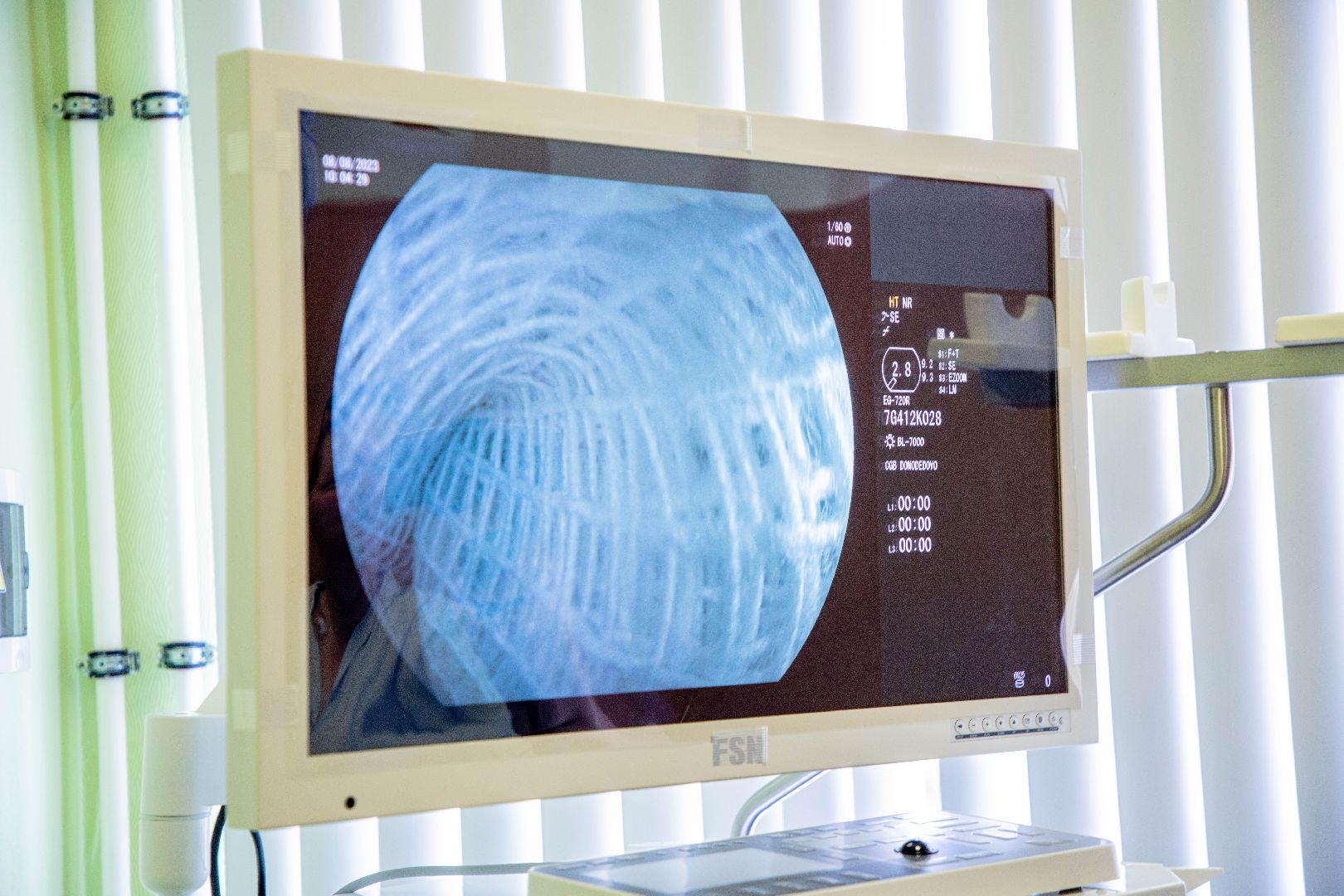 эндоскопическое оборудование, Домодедовская больница