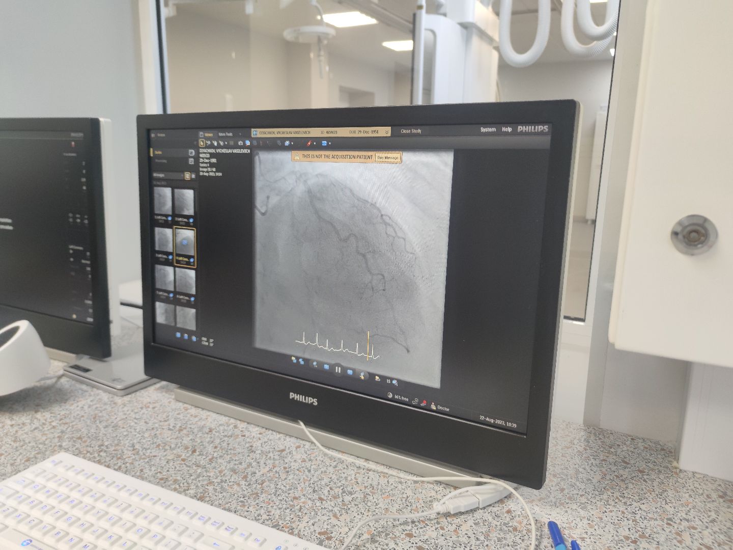 Сосудистый центр, операции, коронарография, стентирование, фбуз мсч №9 фмба россии, Дубна