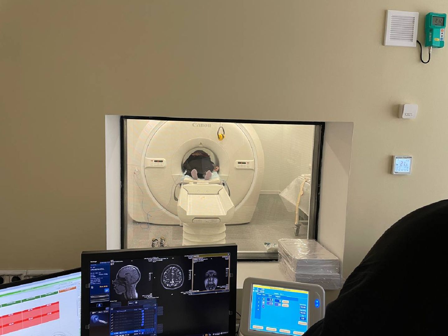 МРТ, Мытищи, ОМС, Поликлиника №2