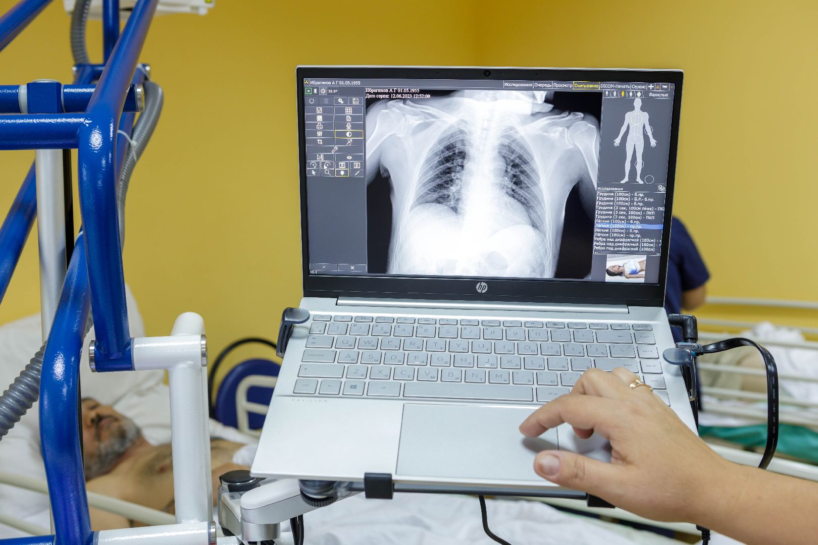 Люберцы, рентген, установки, маломобильные пациенты