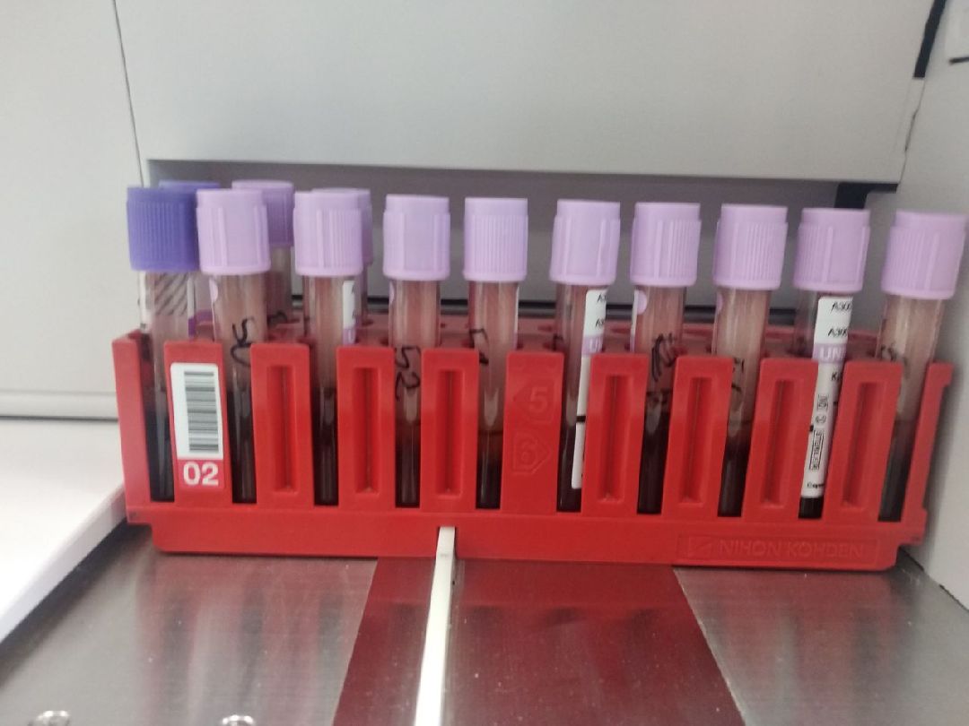 Дмитров, Дмитровская областная больница, клинико-диагностическая лаборатория