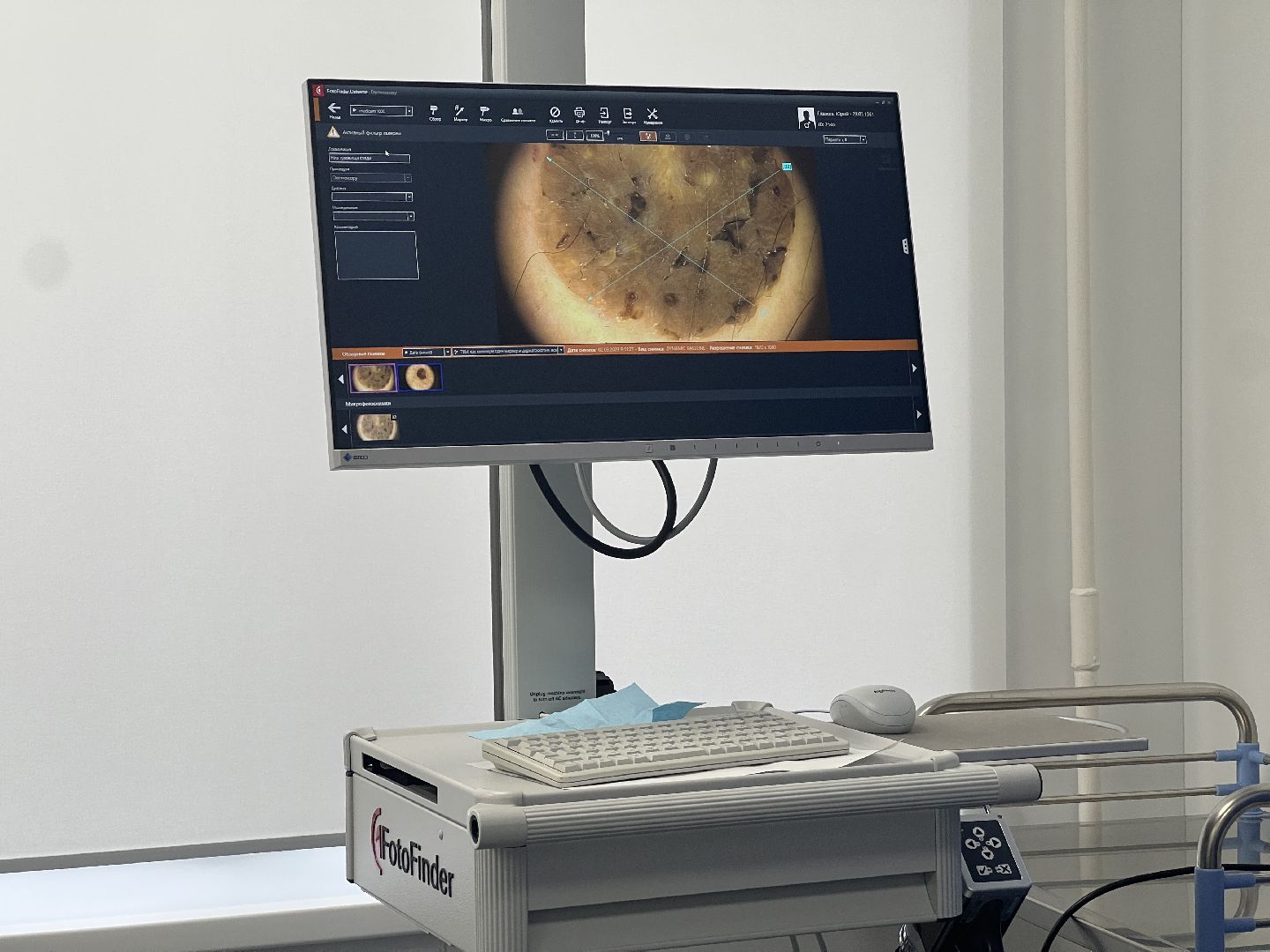 Химки, медицина, день здоровой кожи