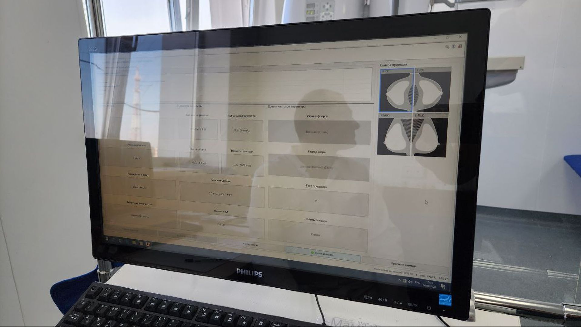 Дмитровская областная больница, Взрослая поликлиника, Маммограф