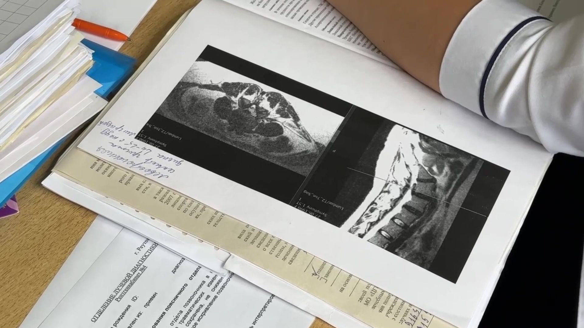 Реутов, Медицина, здравоохранение, врачи, операции, нейрогирургия,