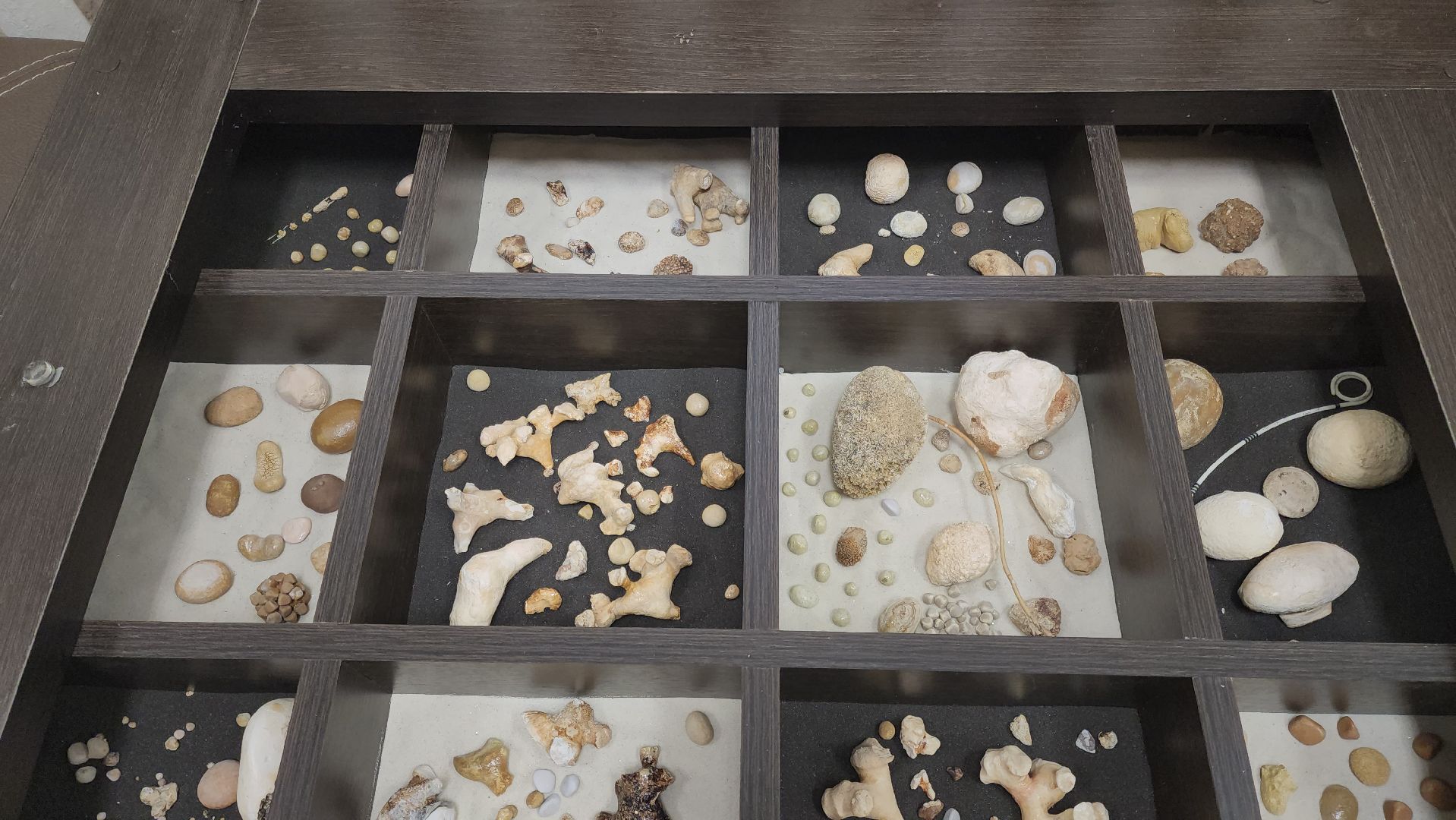 Подольск, Урология, Медицина, Здоровье, Камни в почках,