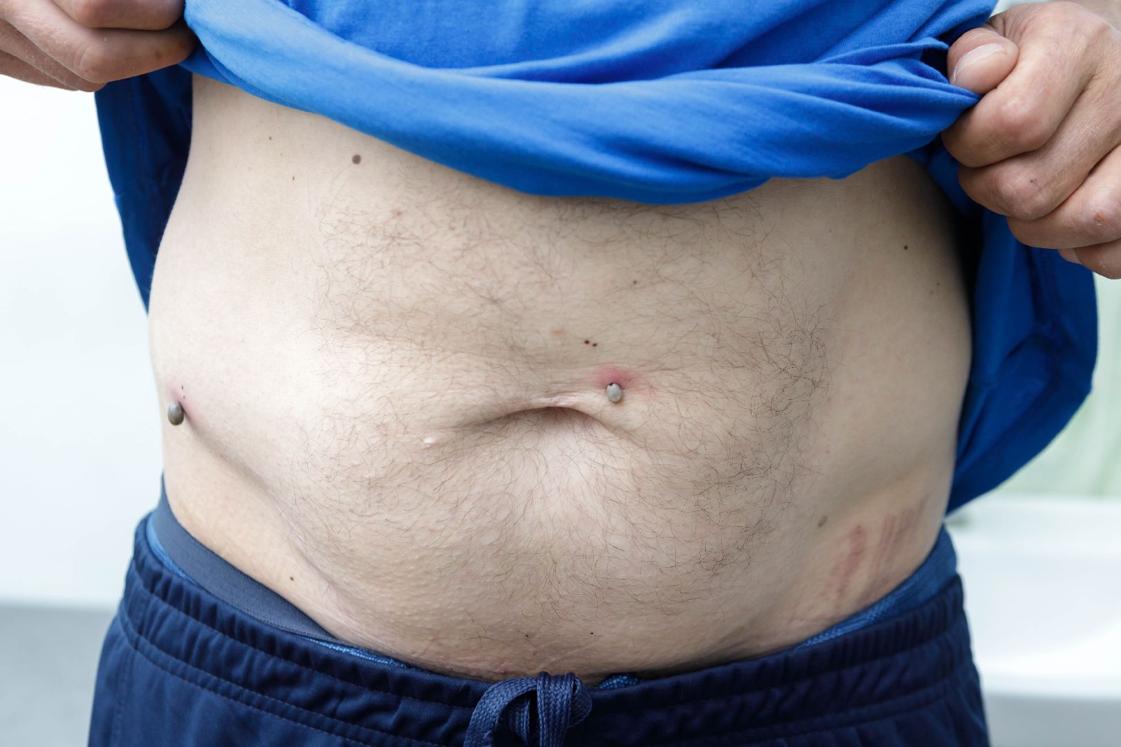 люберцы, клещи, травмпункт,