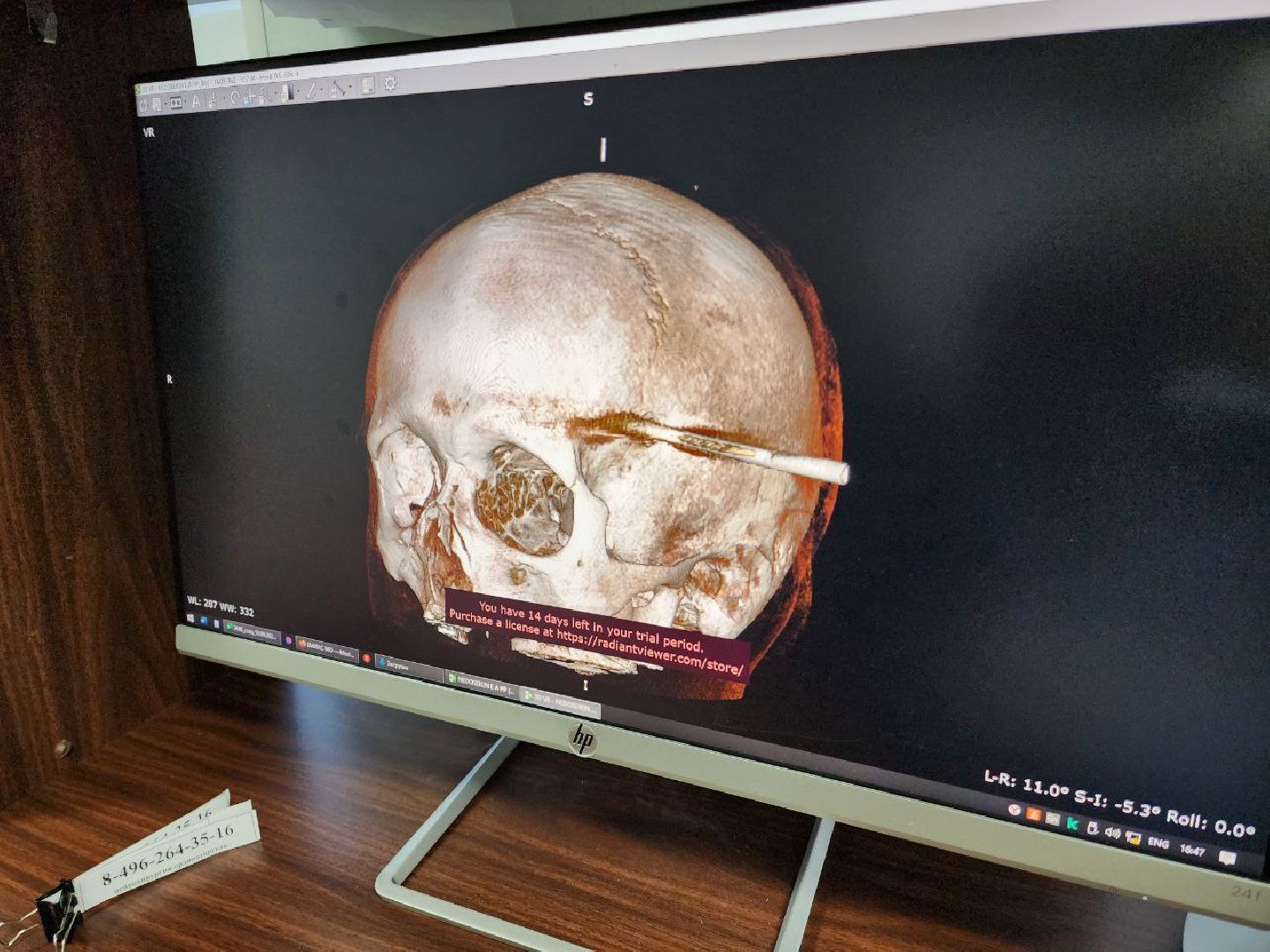 Солнечногорск, Медицина, Врач, Операция, Пациент,