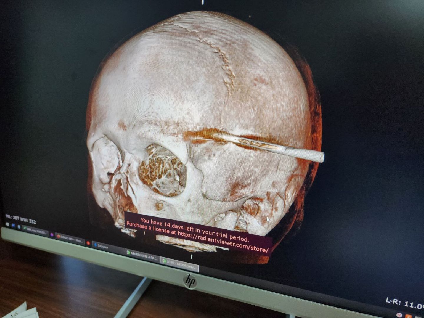 Солнечногорск, Медицина, Врач, Операция, Пациент,