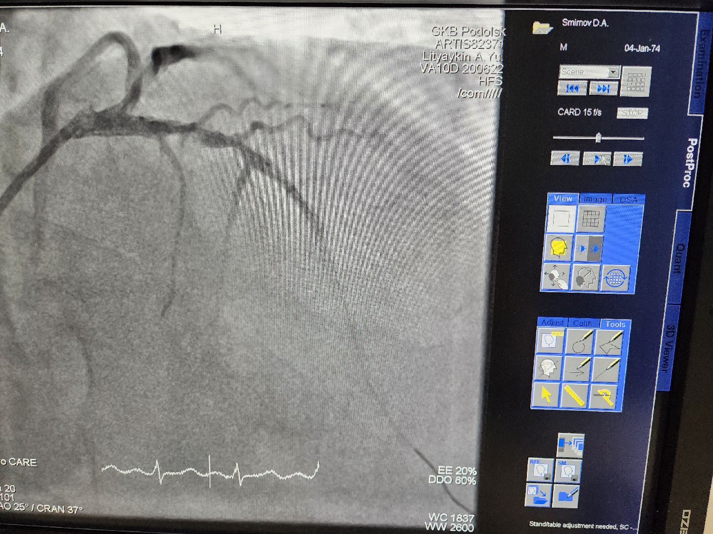 Подольск, Медицина, День сердца, Кардиолог, Здоровье,