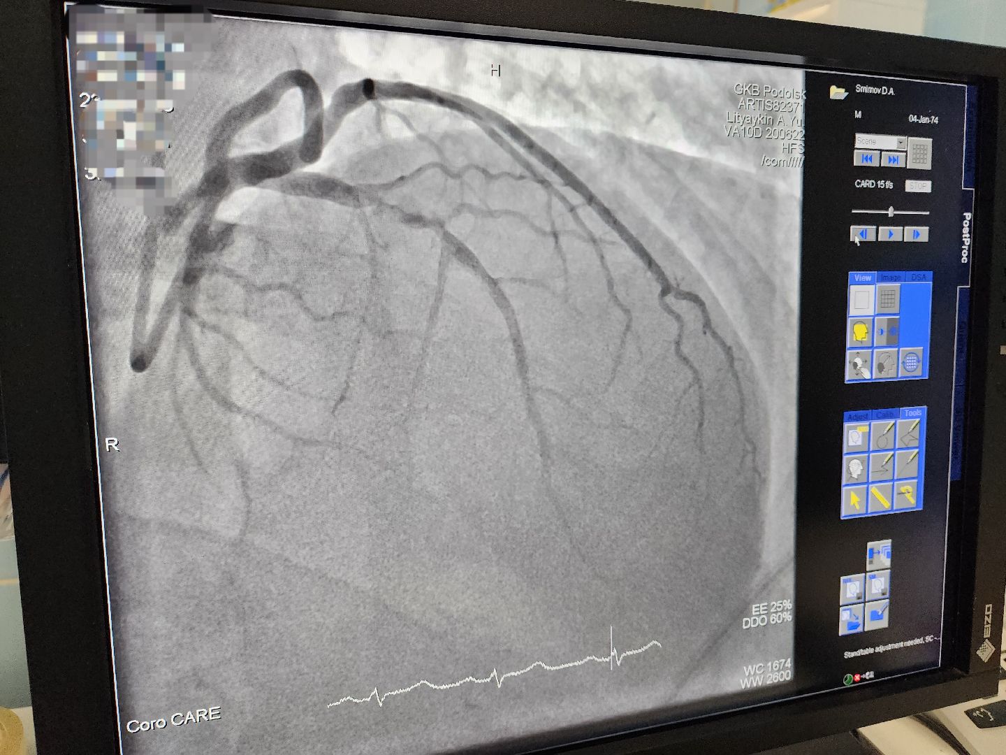 Подольск, Медицина, День сердца, Кардиолог, Здоровье,