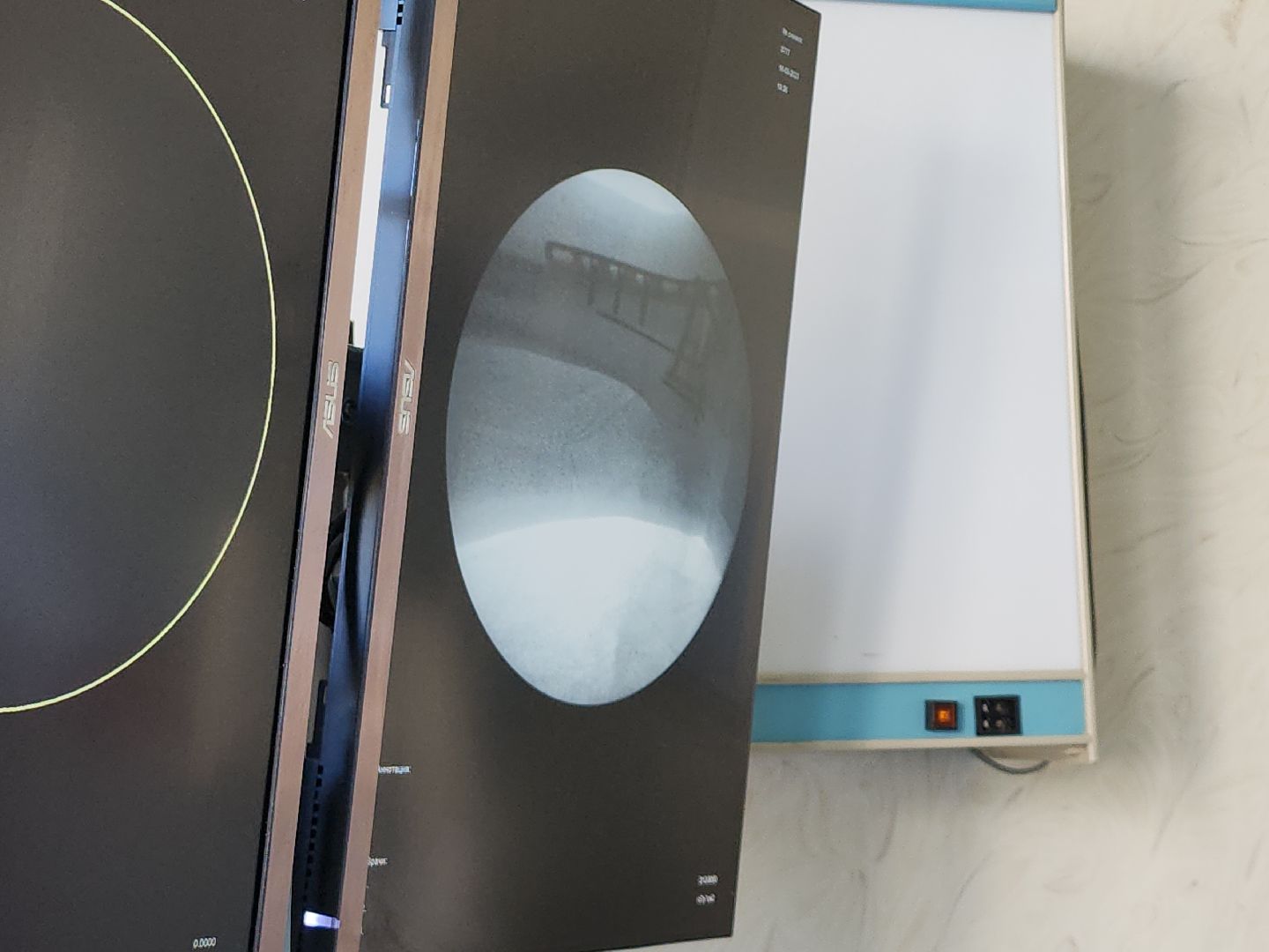 медицина, рентген, новая аппаратура, видное, проект здравоохранение, подмгсковье,