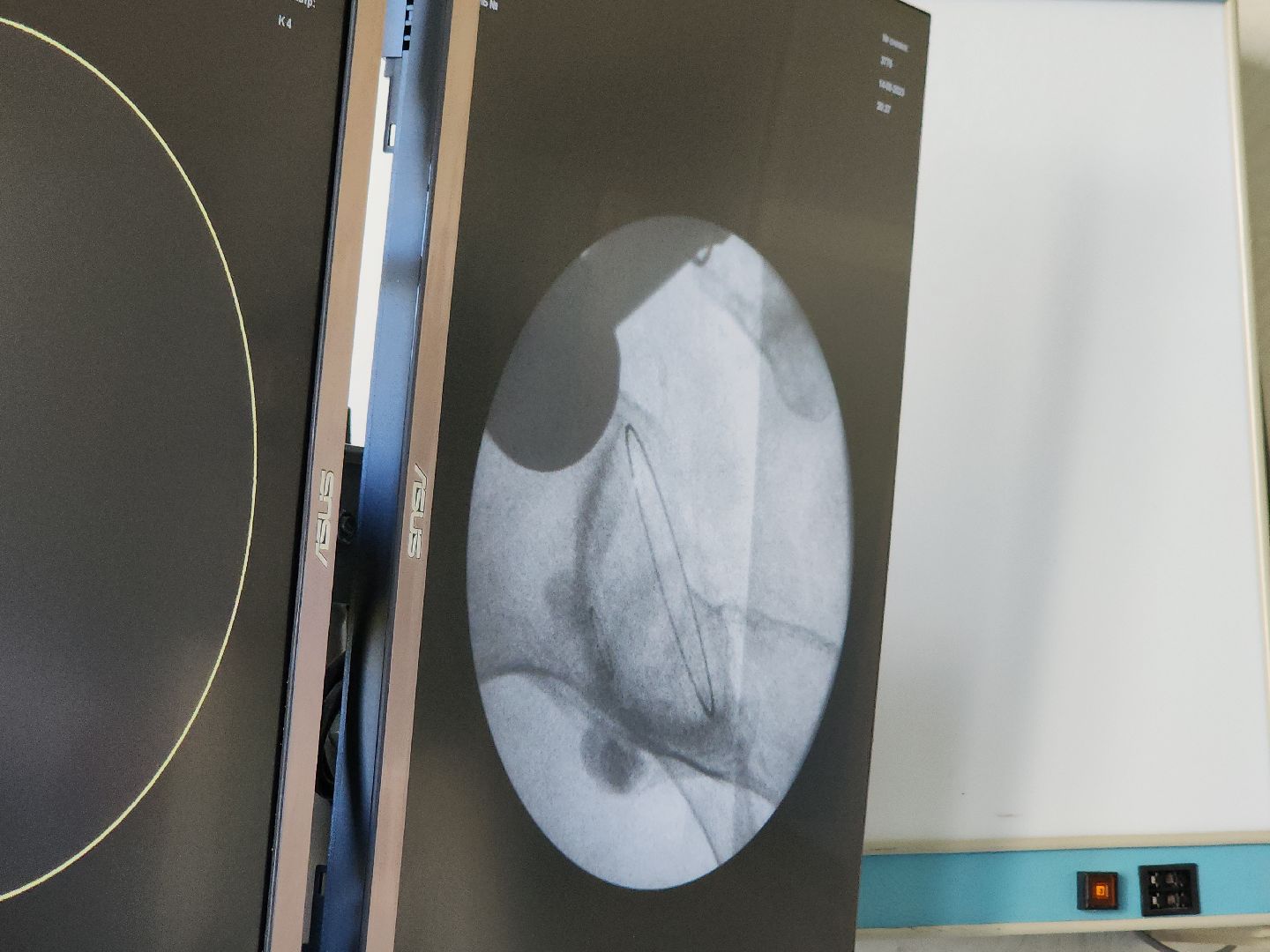 медицина, рентген, новая аппаратура, видное, проект здравоохранение, подмгсковье,