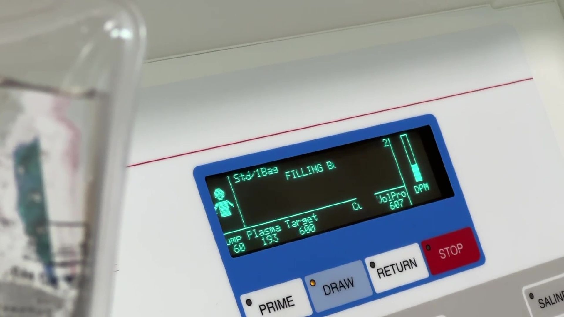 Реутов, медицина, плазма, кровь, рак, поазмаферез, гемодиализ, ЦГКБ,