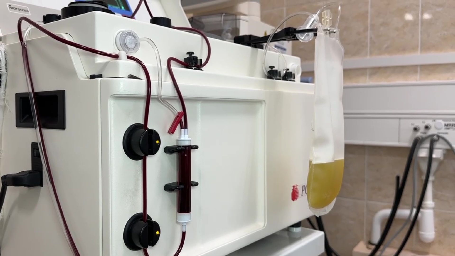 Реутов, медицина, плазма, кровь, рак, поазмаферез, гемодиализ, ЦГКБ,