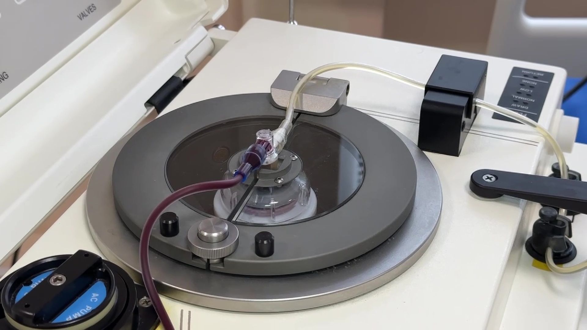 Реутов, медицина, плазма, кровь, рак, поазмаферез, гемодиализ, ЦГКБ,