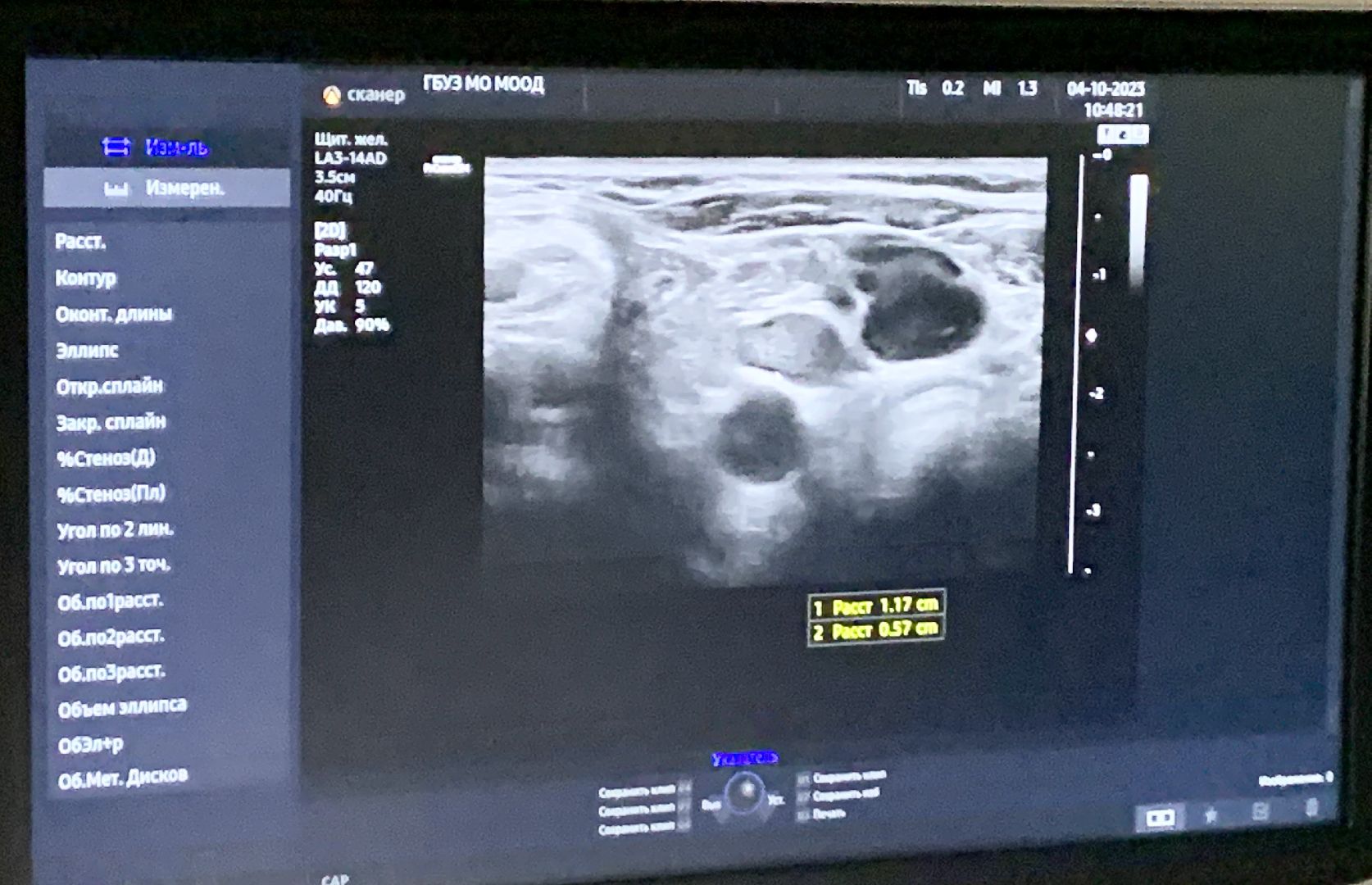 Балашиха, Подмосковье, Медицина, УЗИ,