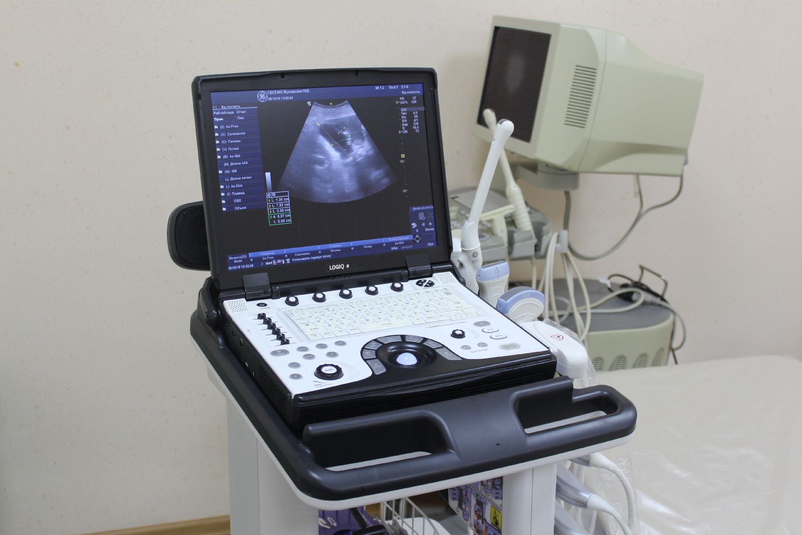 Жуковская ОКБ, больница, УЗИ, Семенов, Кармышаков, холтер,