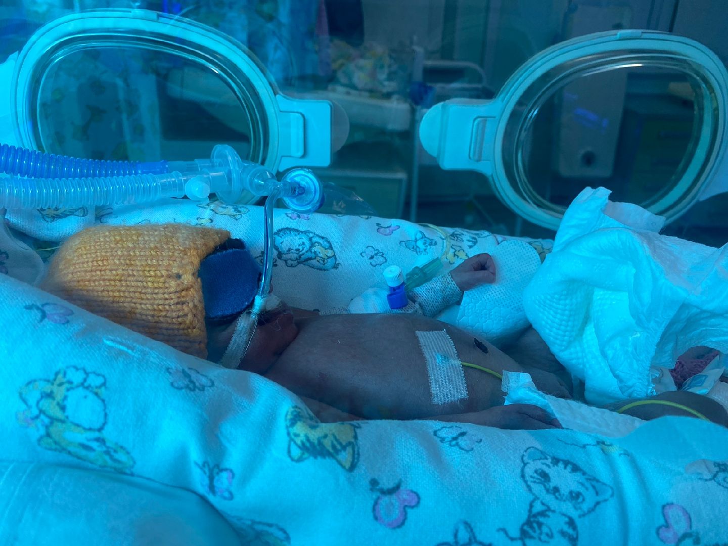 Балашиха, Подмосковье, Медицина, Московский областной перинатальный центр, Хирург, Детская хирургия,