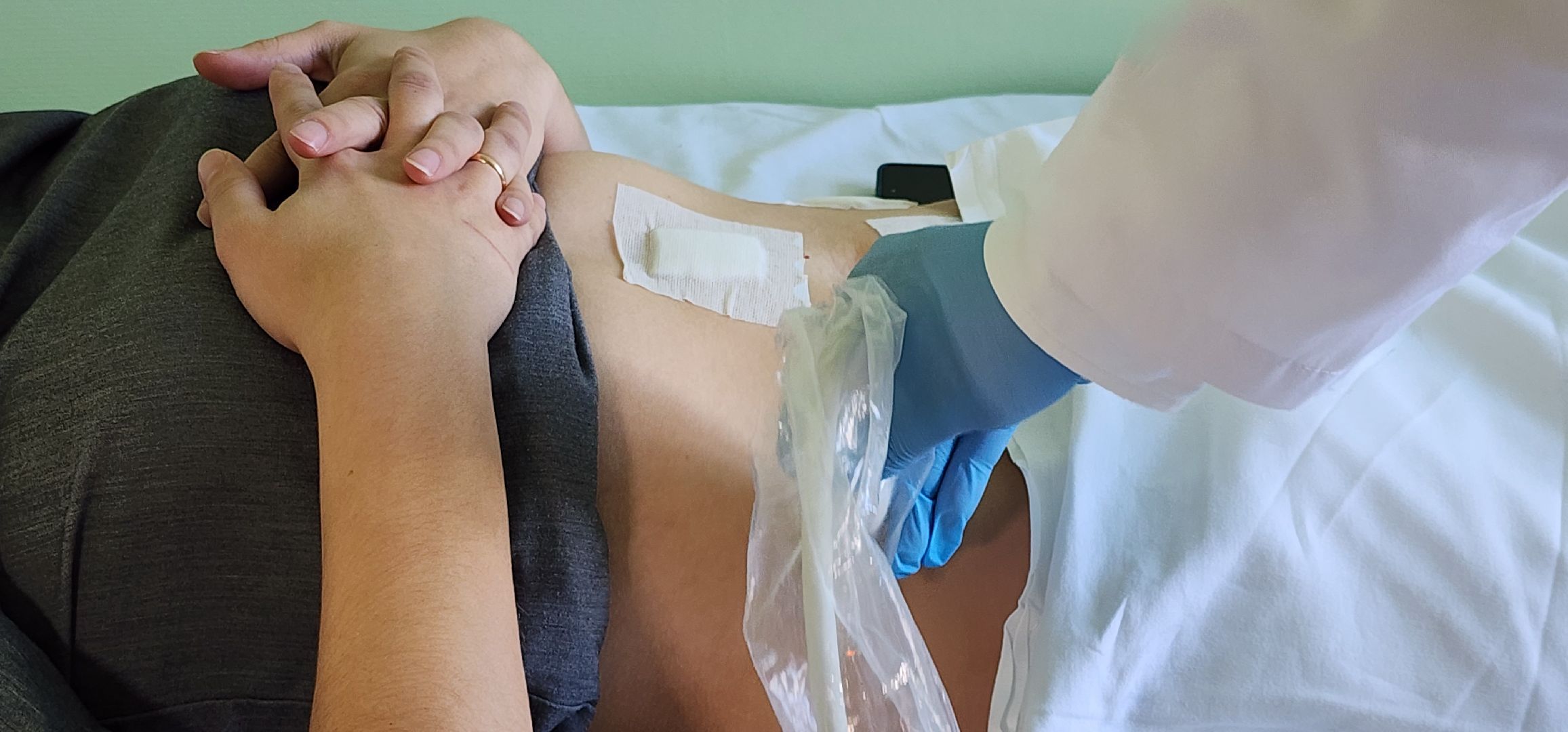 ТАР - блок, обезболивание, домодедовская больница,