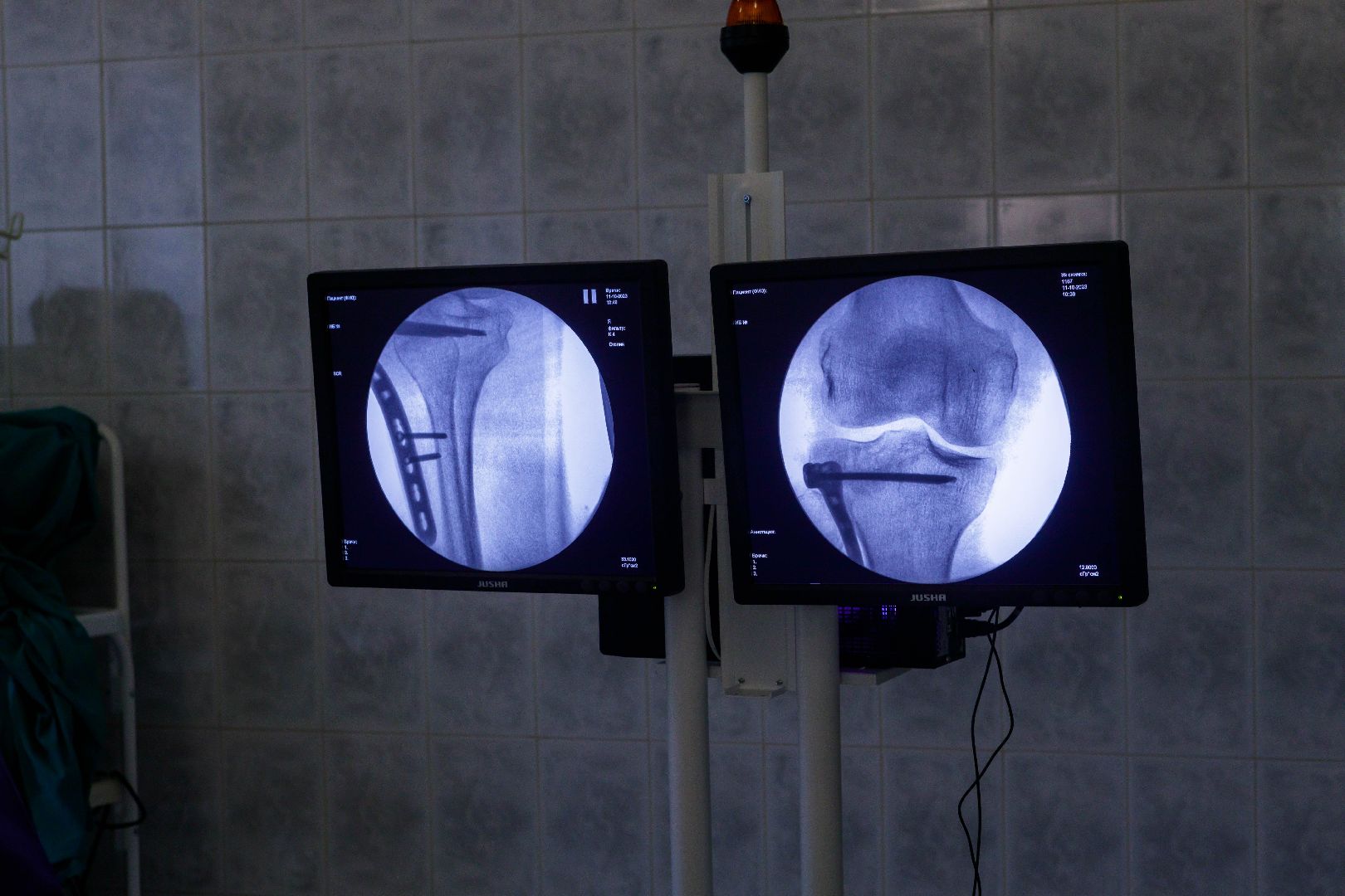 Люберцы, Эндопротезирование, хирург, травматолог,