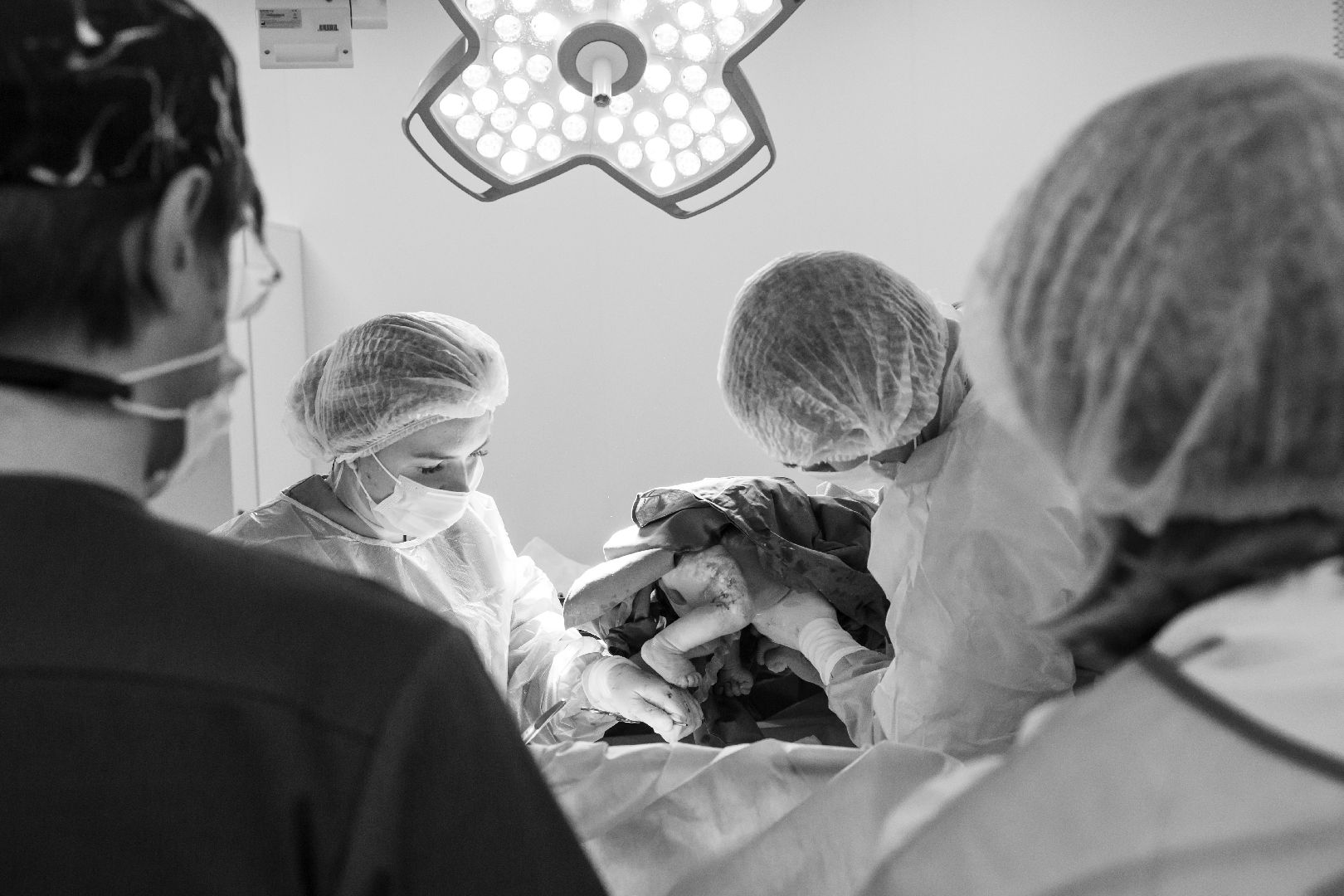 Обвитие пуповиной, Спасение новорожденного, наро-фоминский перинатальный центр, Неонатологи Подмосковья,