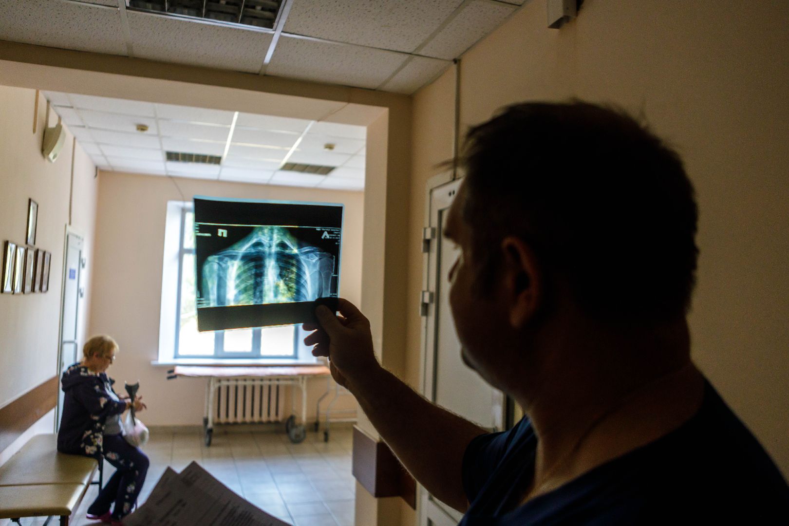 люберцы, Остеопороз, люберецкая областная больница,